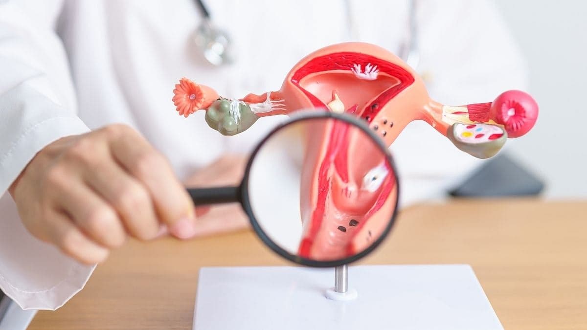 Ovarian Cancer Awareness Month: Understanding The 'Silent Killer' And Exploring Ayurveda For Support 