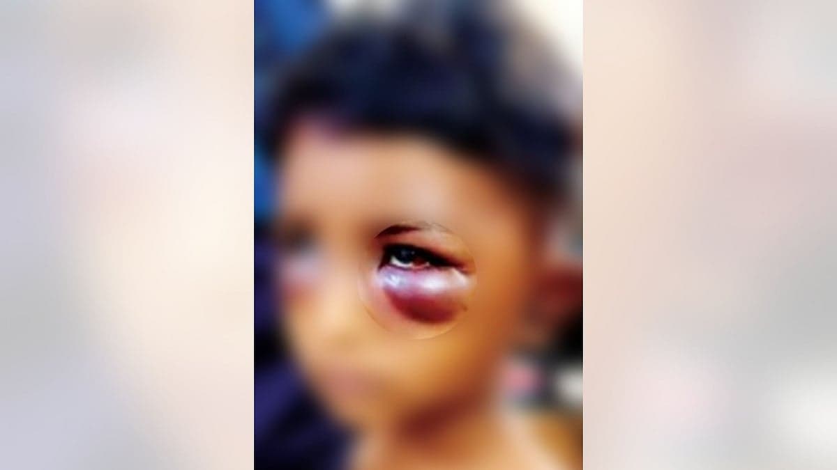 Eight-Year-Old Boy Rescued After Father Allegedly Assaults, Locks Him Up In Indore
