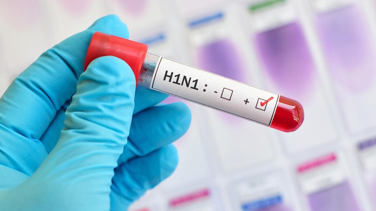 Jharkhand health department sounds alert after 8 persons tested positive for swine flu