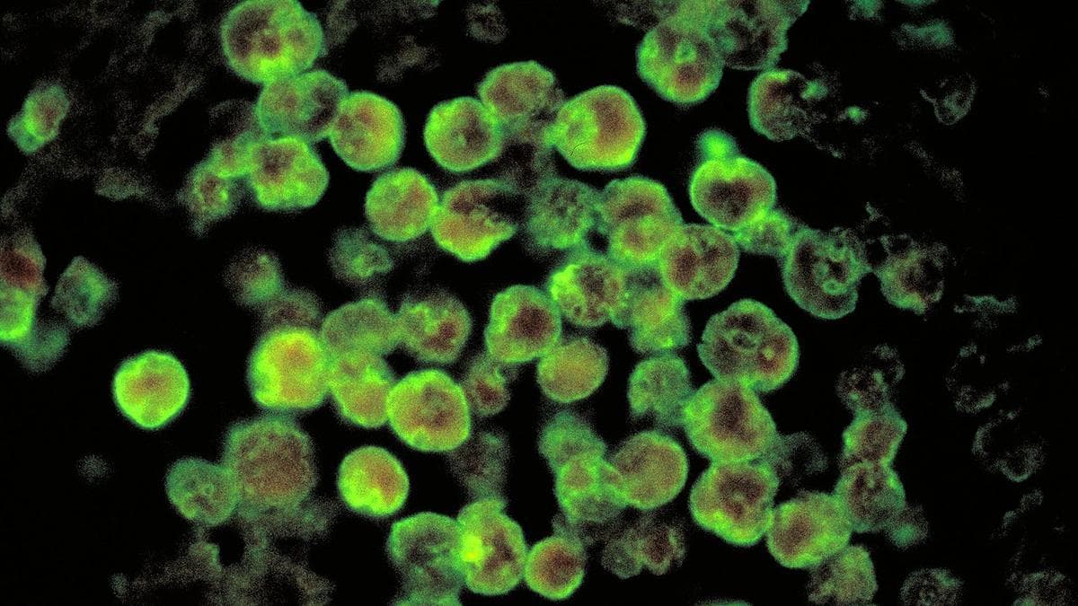 ICMR study identifies well water as major risk factor for amoebic meningoencephalitis in Keralam